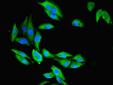 CMBL Antibody in Immunocytochemistry (ICC/IF)