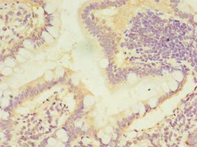 CMBL Antibody in Immunohistochemistry (Paraffin) (IHC (P))