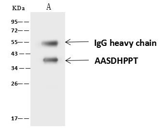 AASDHPPT Antibody in Immunoprecipitation (IP)