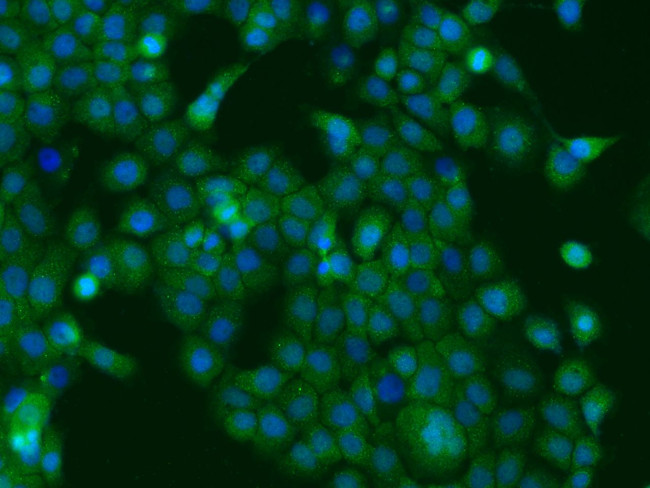 Adenylate Kinase 1 Antibody in Immunocytochemistry (ICC/IF)