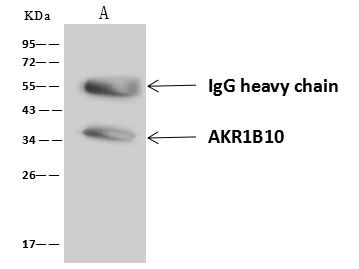 AKR1B10 Antibody in Immunoprecipitation (IP)