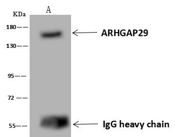 PARG1 Antibody in Immunoprecipitation (IP)