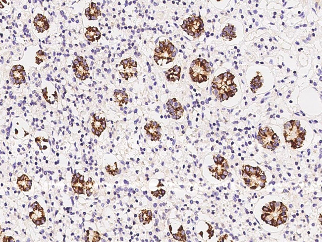 CPS1 Antibody in Immunohistochemistry (Paraffin) (IHC (P))