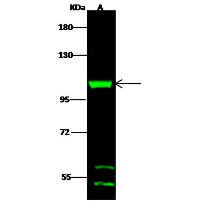 DHTKD1 Antibody in Western Blot (WB)