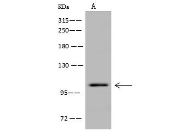 Dynamin 1 Antibody in Western Blot (WB)