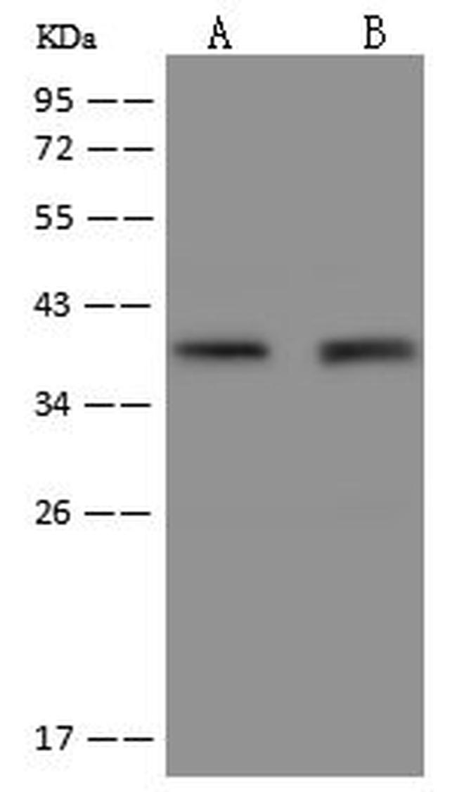 FAM76B Antibody in Western Blot (WB)