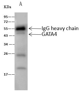 GATA4 Antibody in Immunoprecipitation (IP)
