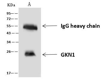 GKN1 Antibody in Immunoprecipitation (IP)