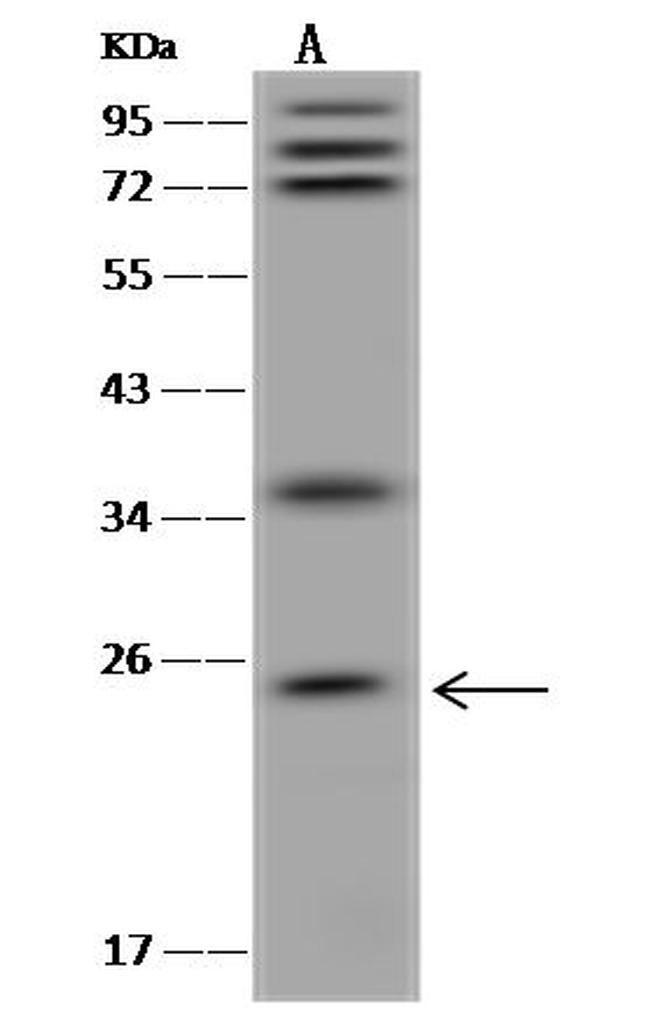 GKN1 Antibody in Western Blot (WB)