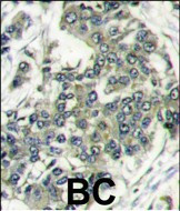 eIF4E Antibody in Immunohistochemistry (Paraffin) (IHC (P))