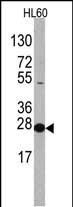 eIF4E Antibody in Western Blot (WB)