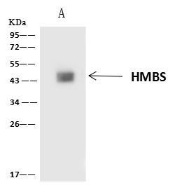 HMBS Antibody in Immunoprecipitation (IP)