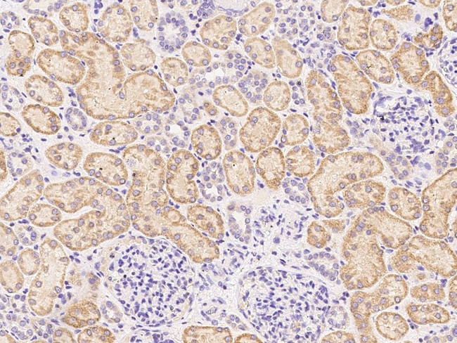 IFNGR1 Antibody in Immunohistochemistry (Paraffin) (IHC (P))