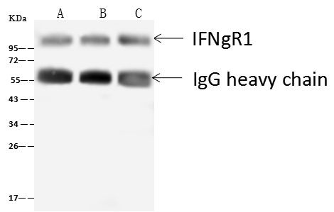 IFNGR1 Antibody in Immunoprecipitation (IP)