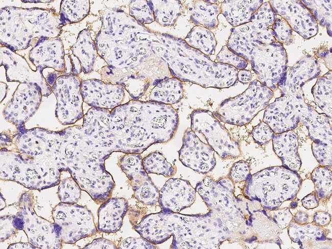 IFNGR1 Antibody in Immunohistochemistry (Paraffin) (IHC (P))