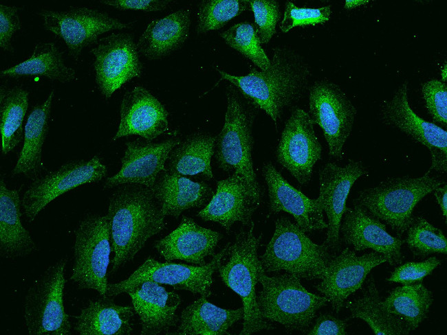 IKK gamma Antibody in Immunocytochemistry (ICC/IF)