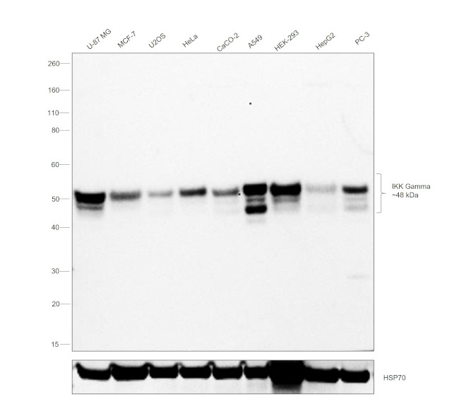 IKK gamma Antibody in Western Blot (WB)