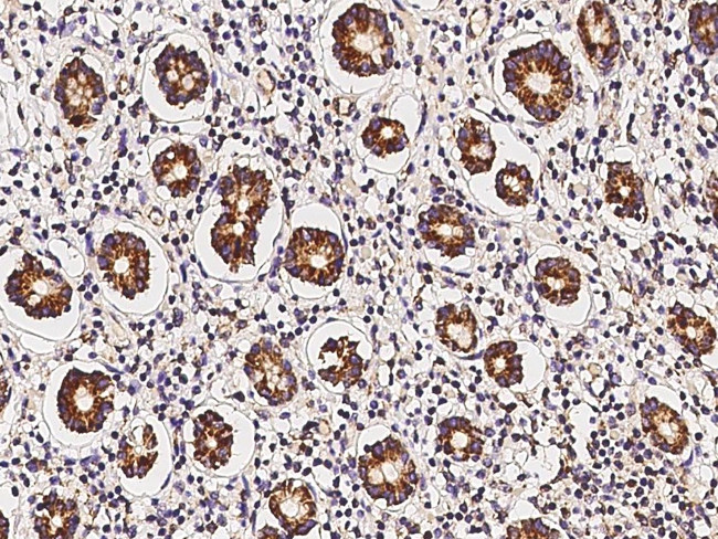 MRPL9 Antibody in Immunohistochemistry (Paraffin) (IHC (P))