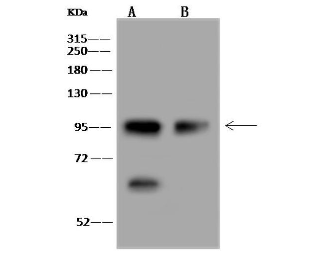 MSH2 Antibody in Western Blot (WB)