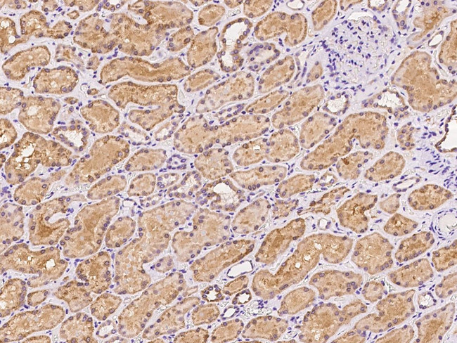 MTHFS Antibody in Immunohistochemistry (Paraffin) (IHC (P))