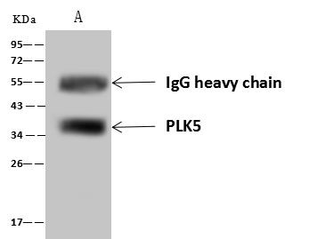 PLK5 Antibody in Immunoprecipitation (IP)