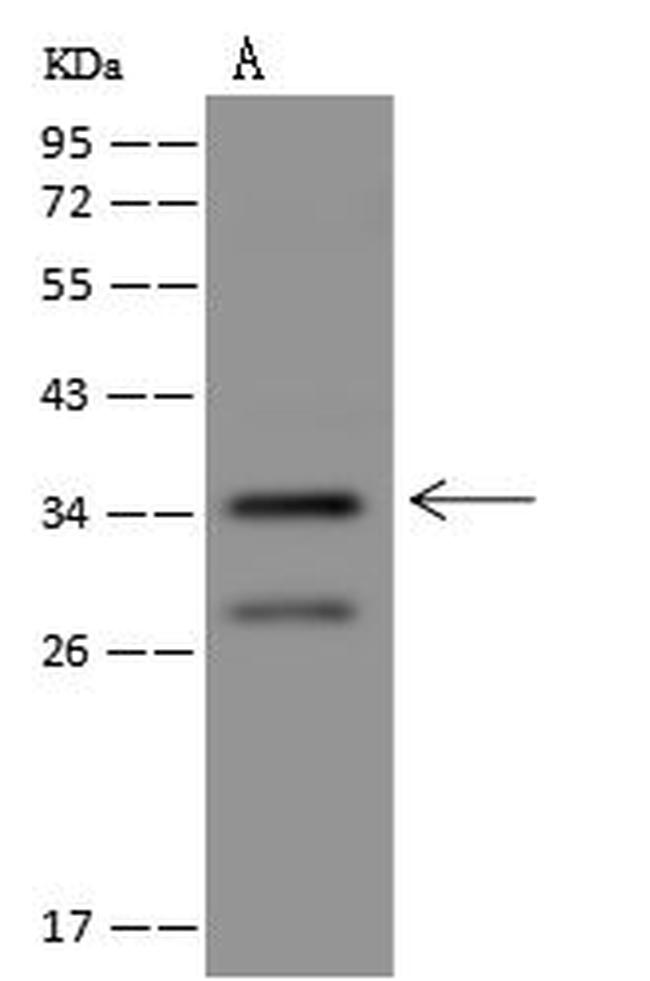 PLK5 Antibody in Western Blot (WB)