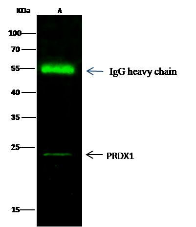 PRDX1 Antibody in Immunoprecipitation (IP)