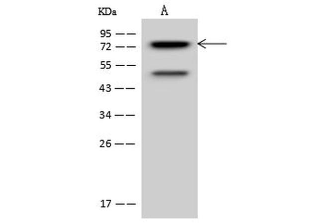 PKC delta Antibody in Western Blot (WB)