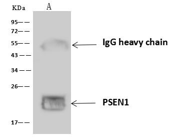 Presenilin 1 Antibody in Immunoprecipitation (IP)