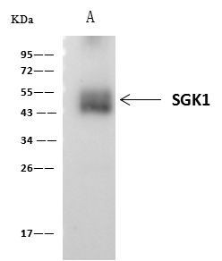 SGK1 Antibody in Immunoprecipitation (IP)