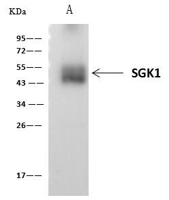 SGK1 Antibody in Immunoprecipitation (IP)