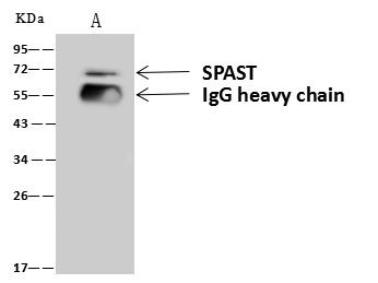 Spastin Antibody in Immunoprecipitation (IP)