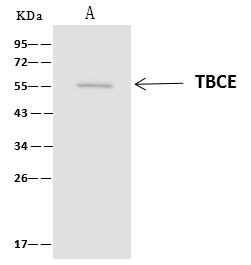 TBCE Antibody in Immunoprecipitation (IP)