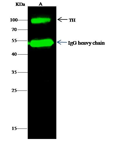 Tyrosine Hydroxylase Antibody in Immunoprecipitation (IP)