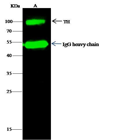 Tyrosine Hydroxylase Antibody in Immunoprecipitation (IP)