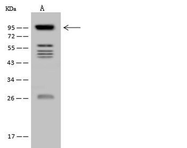 VPS53 Antibody in Western Blot (WB)