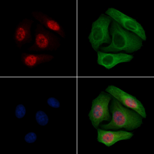 Phospho-IKK gamma (Ser376) Antibody in Immunocytochemistry (ICC/IF)