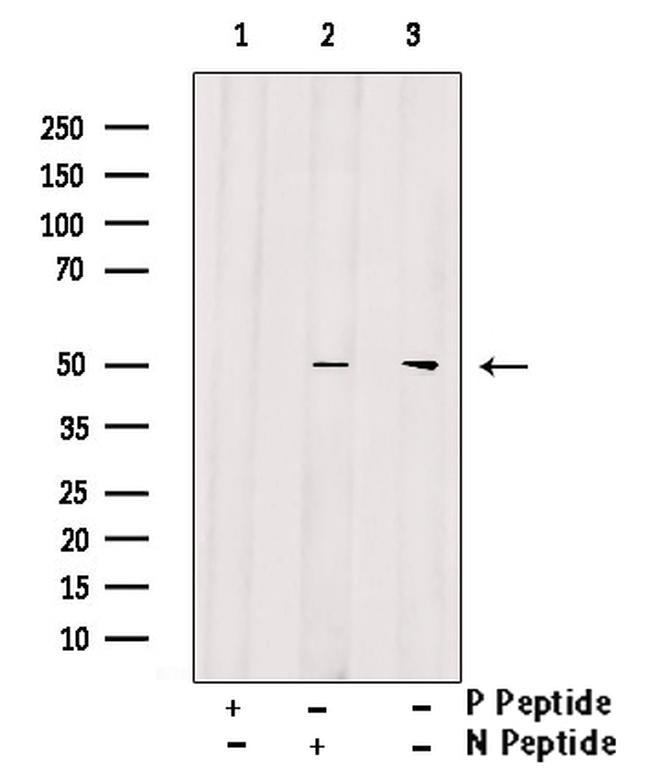 Phospho-IKK gamma (Ser376) Antibody in Western Blot (WB)