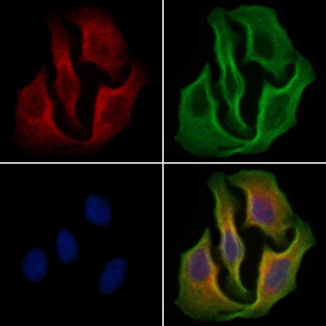 Phospho-EIF2S1 (Ser51) Antibody in Immunocytochemistry (ICC/IF)