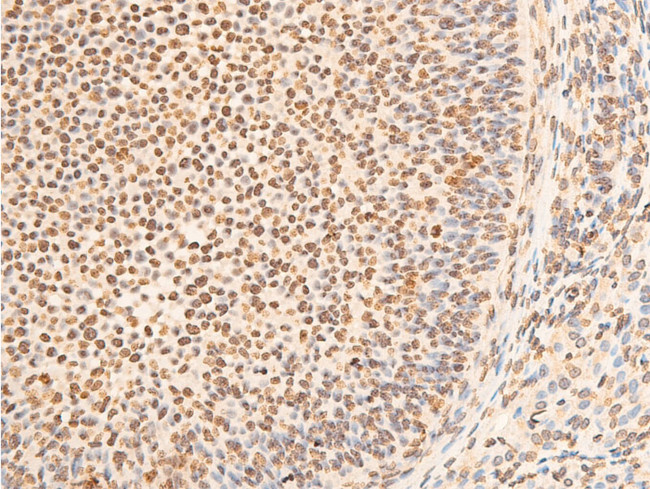 Phospho-EIF2S1 (Ser51) Antibody in Immunohistochemistry (Paraffin) (IHC (P))