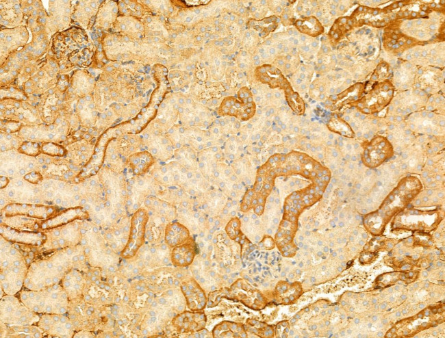 Phospho-EIF2S1 (Ser51) Antibody in Immunohistochemistry (Paraffin) (IHC (P))