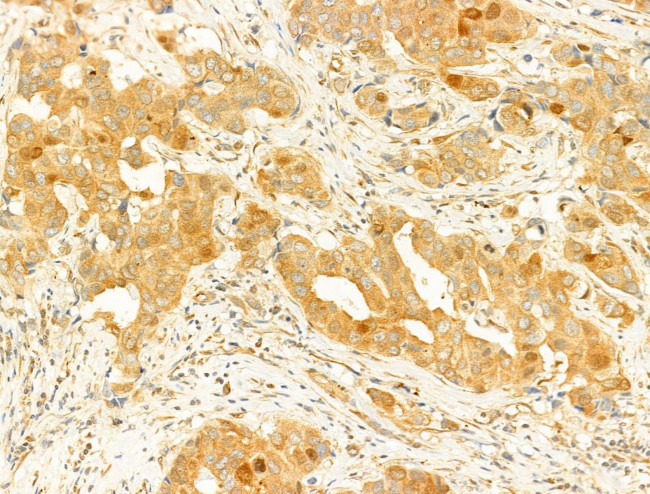 Phospho-EIF2S1 (Ser51) Antibody in Immunohistochemistry (Paraffin) (IHC (P))