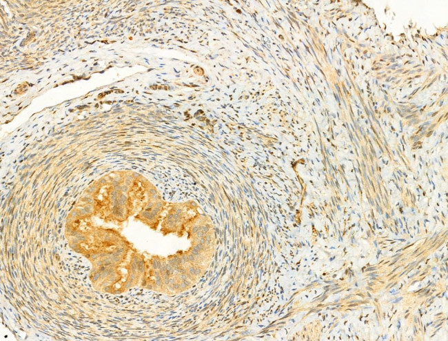 Phospho-EIF2S1 (Ser51) Antibody in Immunohistochemistry (Paraffin) (IHC (P))