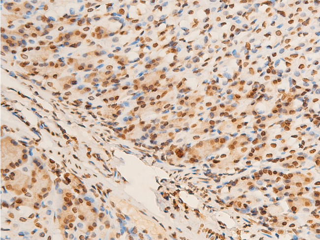 Phospho-EIF2S1 (Ser51) Antibody in Immunohistochemistry (Paraffin) (IHC (P))