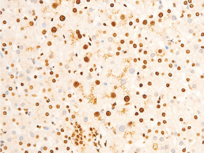 Phospho-EIF2S1 (Ser51) Antibody in Immunohistochemistry (Paraffin) (IHC (P))