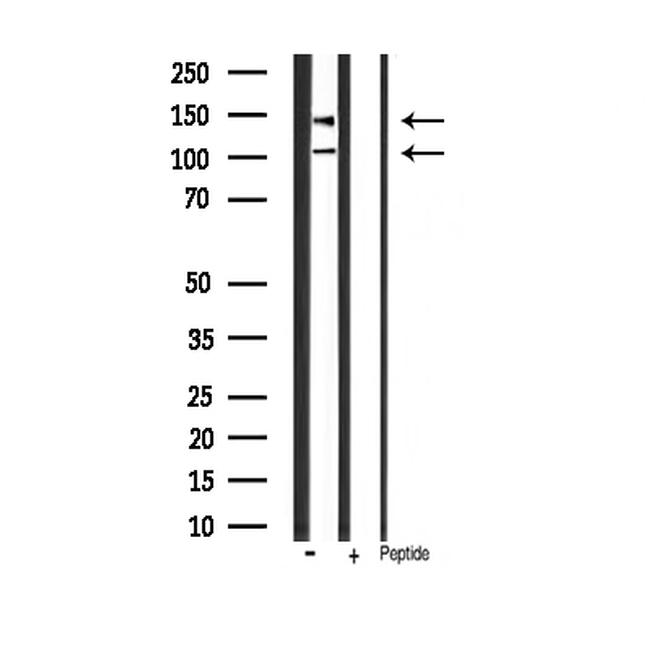 Phospho-IGF1R (Tyr1165, Tyr1166) Antibody in Western Blot (WB)