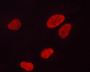 Phospho-Ataxin 1 (Ser775) Antibody in Immunocytochemistry (ICC/IF)