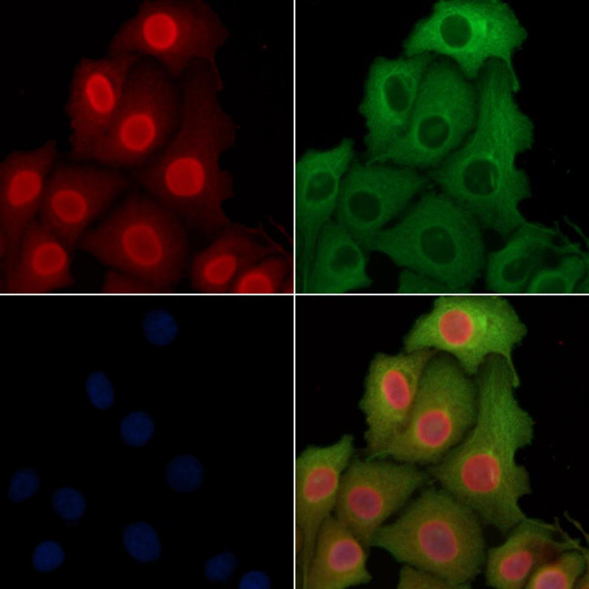 HSP70 Antibody in Immunocytochemistry (ICC/IF)