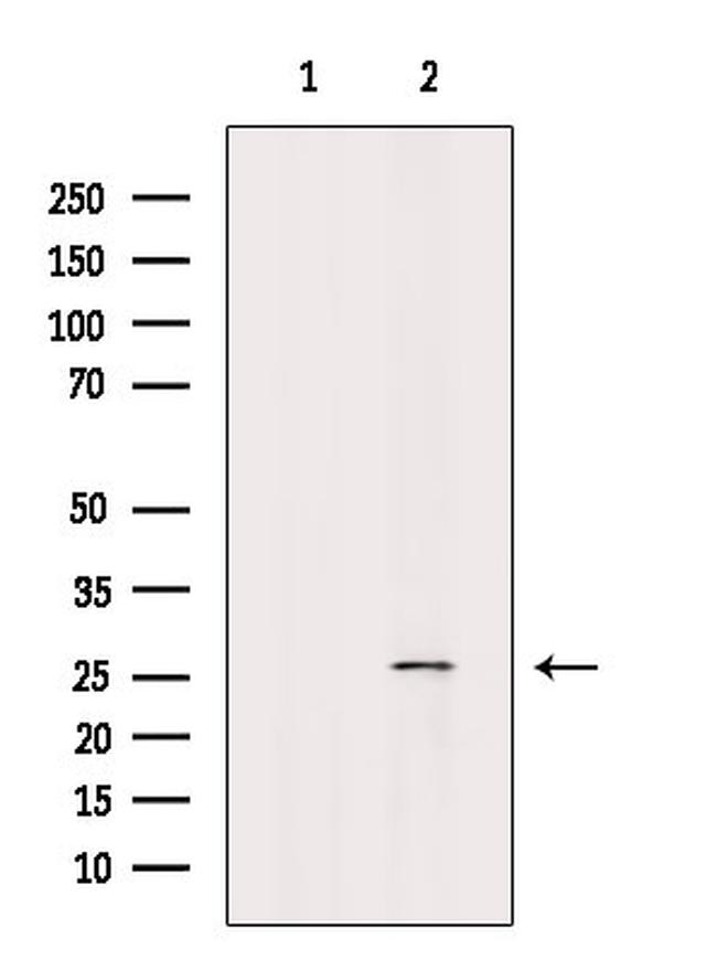 Phospho-Caveolin 2 (Ser23) Antibody in Western Blot (WB)