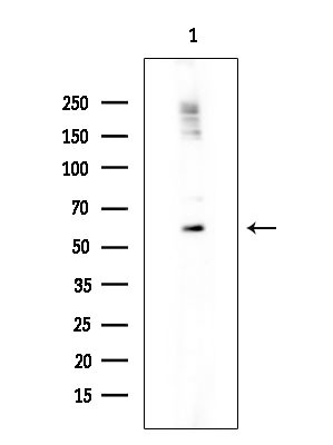 Phospho-p70 S6 Kinase (Ser427) Antibody in Western Blot (WB)